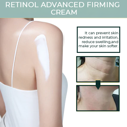 SKINETHICX RETINOL CREAM